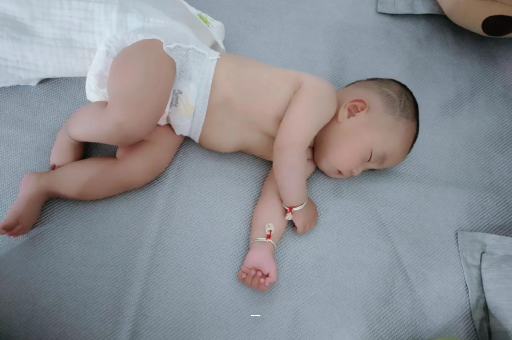 江苏宝宝脸上有白色斑块